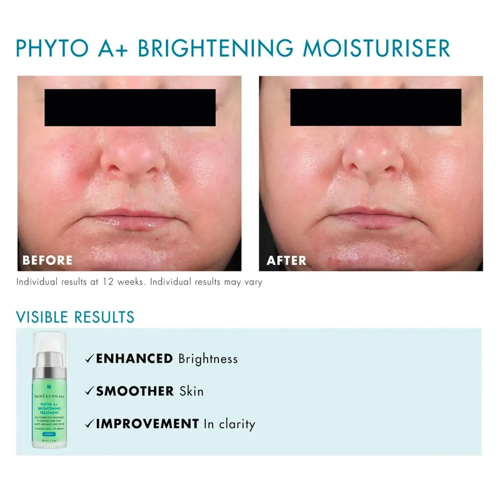 SkinCeuticals | Phyto A+ Brightening Treatment 30ml